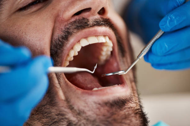 Best Wisdom Tooth Removal  in Twinsburg, OH
